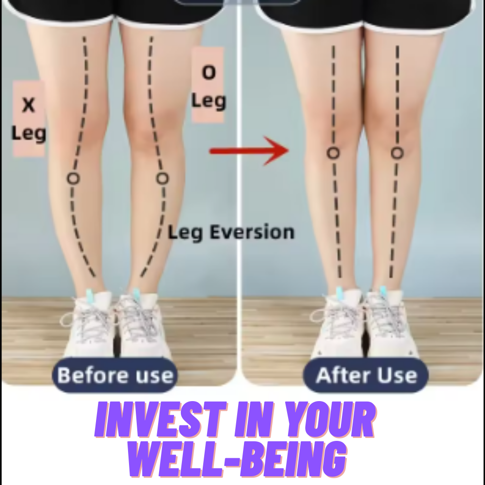 ComfortShoes™ - Calzado Ergonómico Antidolor para Mujer